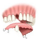 Dentist in Chennai Adyar Omr Ecr Triplicane Chrompet