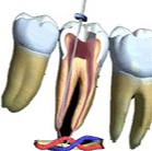Dentist in Chennai Adyar Omr Ecr Triplicane Chrompet