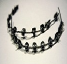 Dentist in Chennai Adyar Omr Ecr Triplicane Chrompet