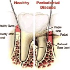 Dentist in Chennai Adyar Omr Ecr Triplicane Chrompet