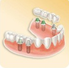 Dentist in Chennai Adyar Omr Ecr Triplicane Chrompet