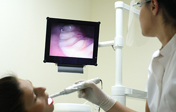 Intra oral camera