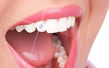 Dentist in Chennai Adyar Omr Ecr Triplicane Chrompet